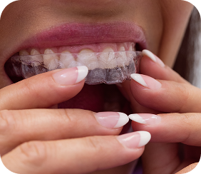 Mouth Guard