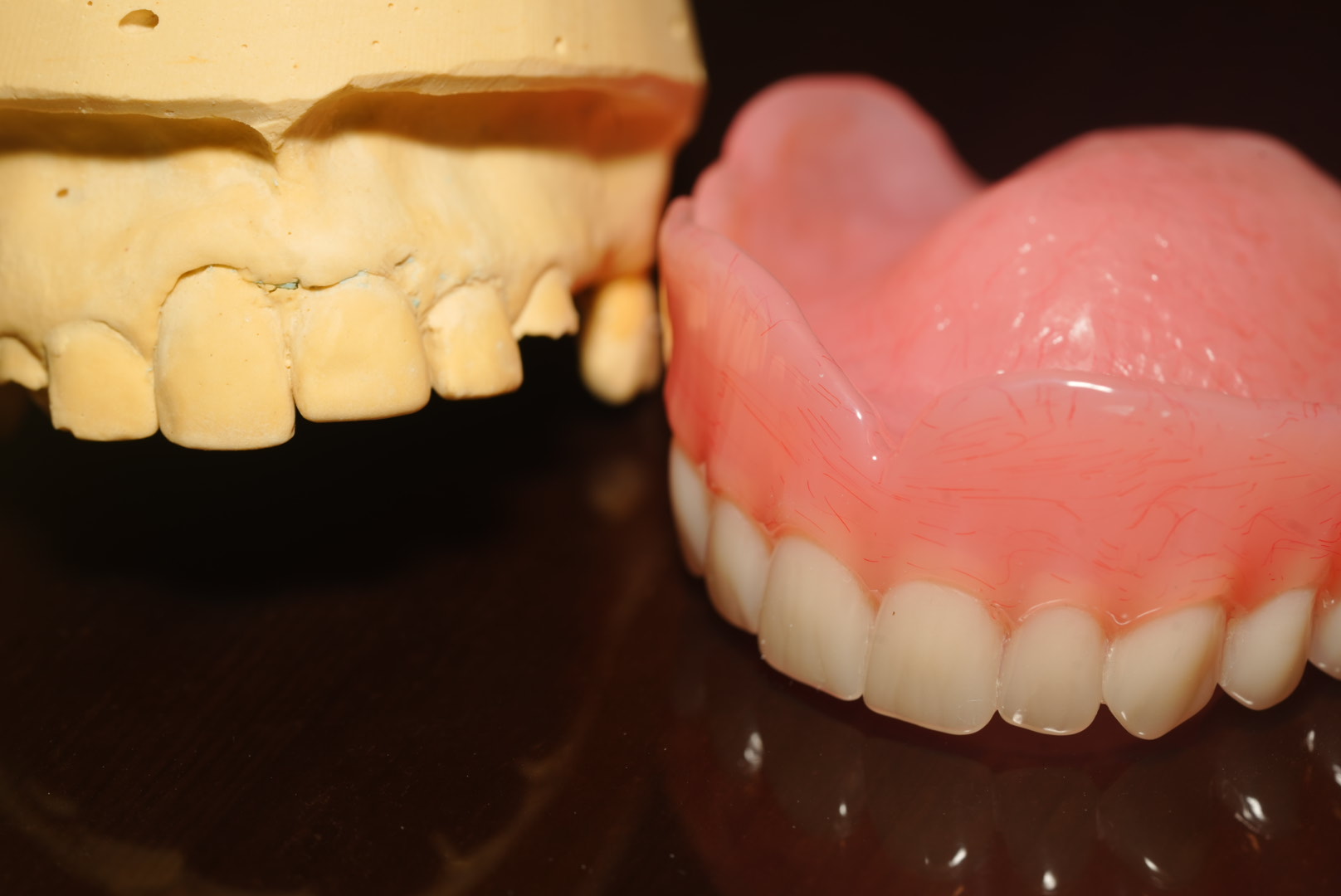 Immediate Dentures