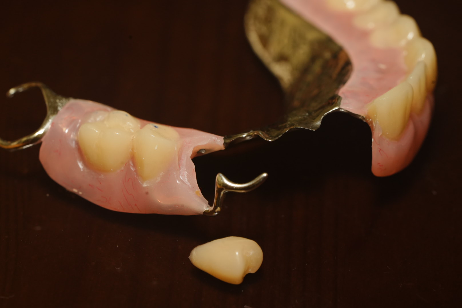 Denture Repairs