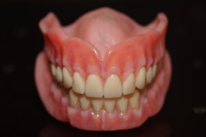 Full Denture